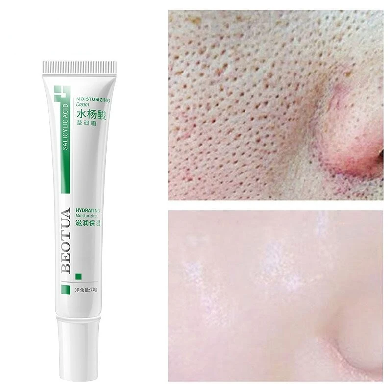 

20g Salicylic Acid Shrink Pores Face Cream Acne Treatment Remove Blackheads Oil Control Moisturizing Firm Whitening Skin Care
