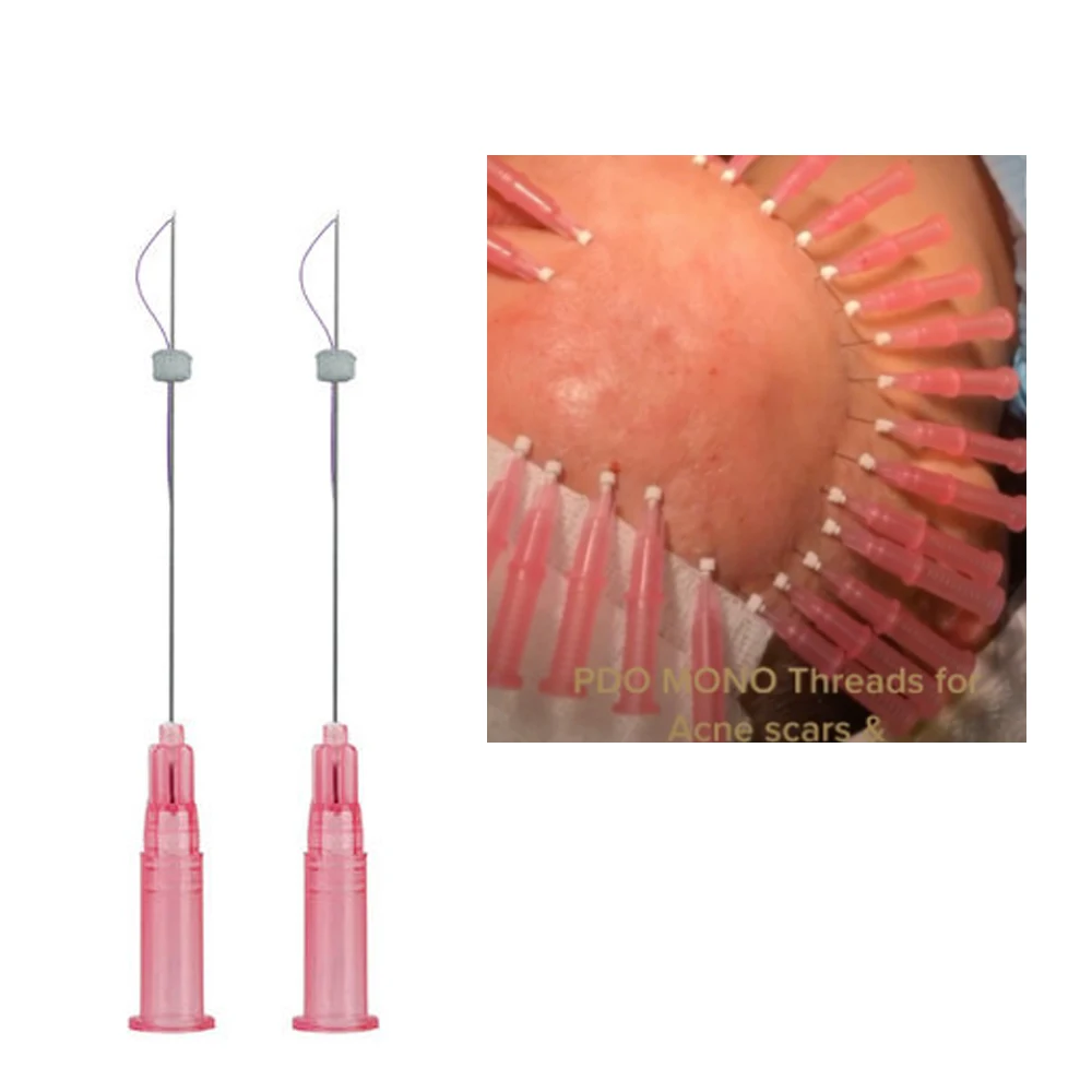 

2022 Korea sterile v line absorbable face twist mono barbed pdo nose lift thread tornado cog 3d 4d 6d pdo thread