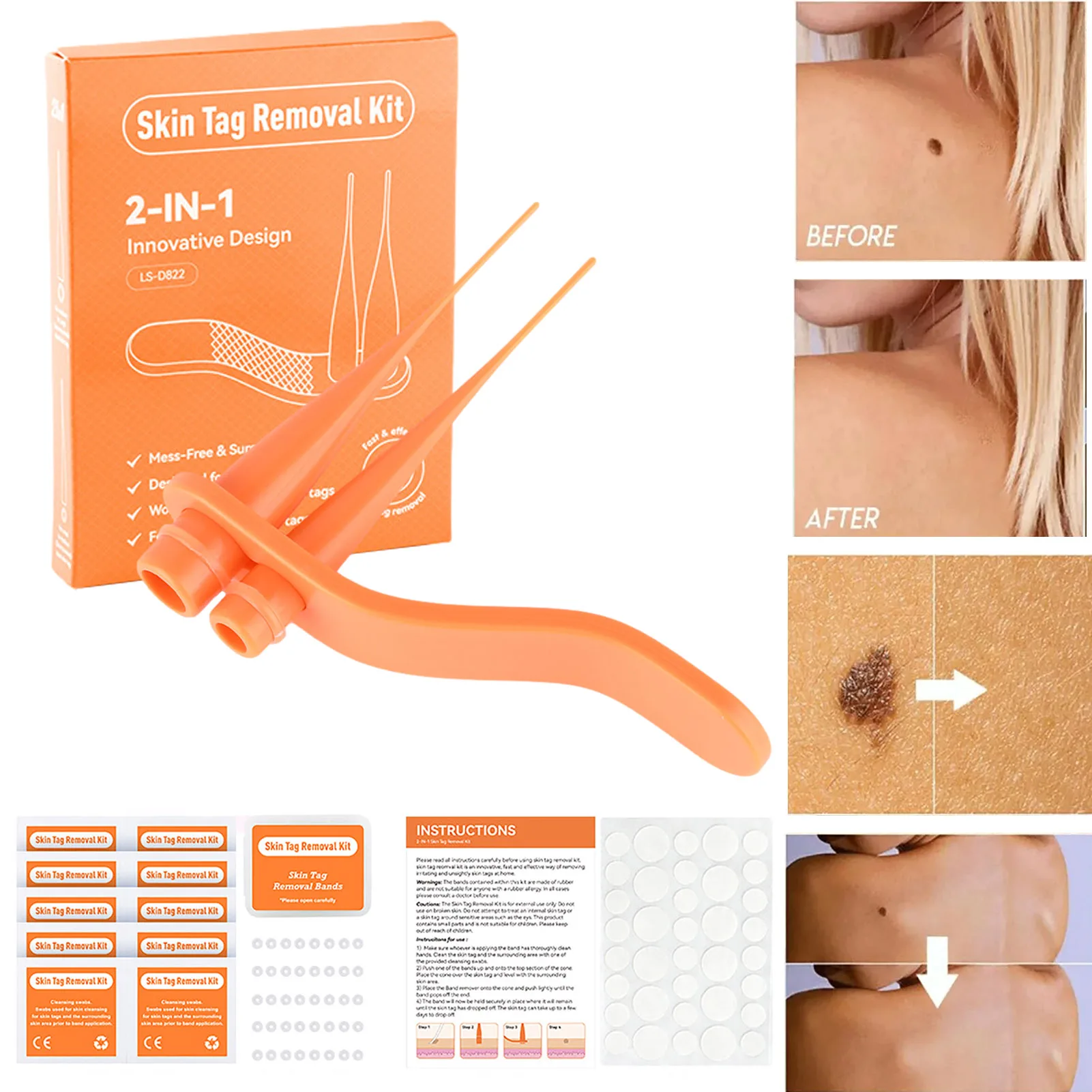 

Skin Tag Removal Kit Home Use Mole Wart Remover Equipment 2-7mm Micro Skin Tags Tool Easy To Clean Skin Care Tool