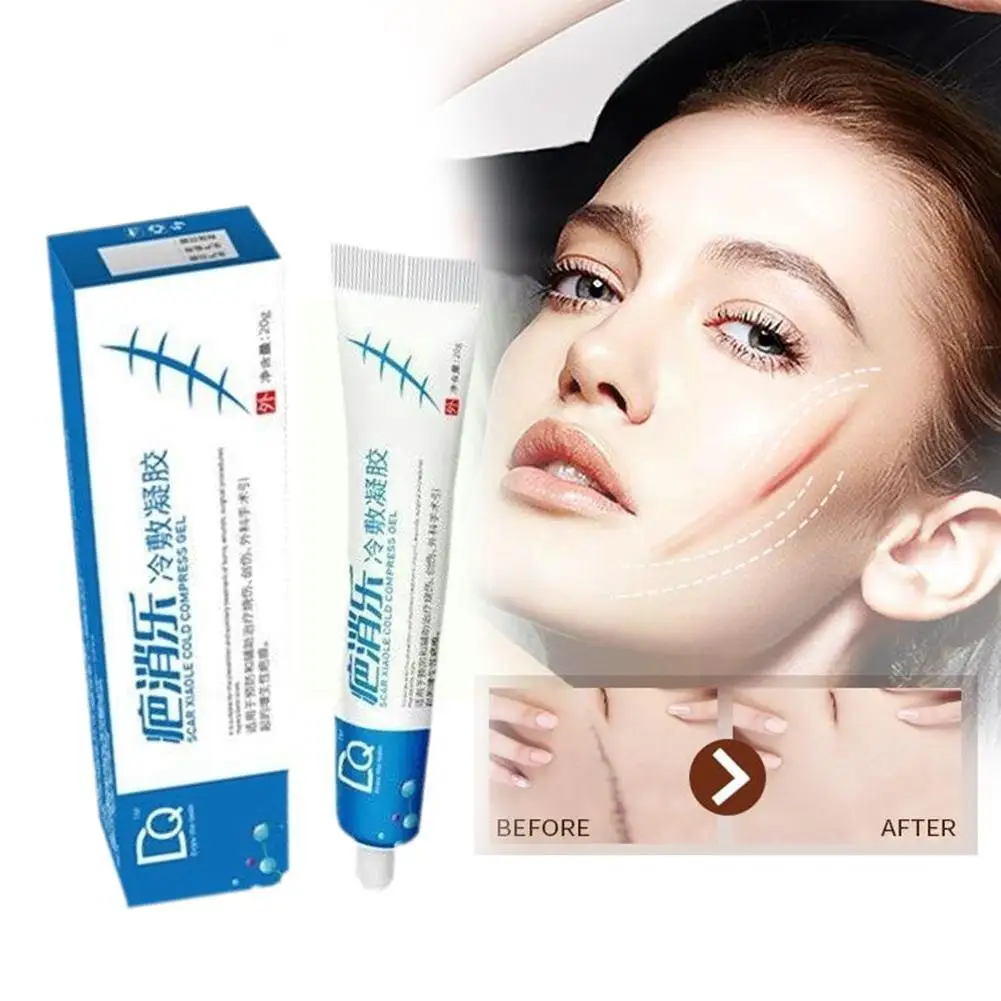 

Effective Acne Scar Removal Cream Pimples Stretch Marks Face Whitening Moisturizing Care Smoothing Gel Acne Skin Remove U1z7