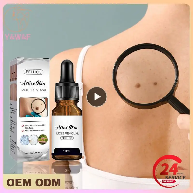 

Wart Mole Removal Painless Fast Remover Serum Wart Tag Serum Skin Removal Mole Fast Remover Skin Care