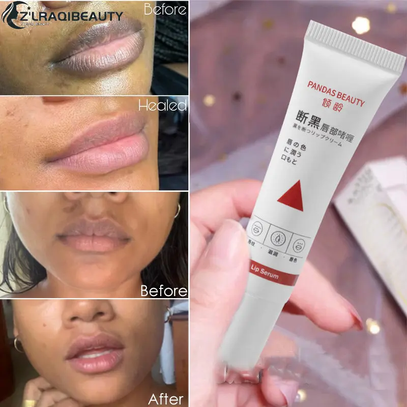 

Naturally Pink Serum Lips Pink Fresh Remove Dark Lips Gel Lightening Essence Cream Balm Repair Fine Line Brighten Lip Exfoliator