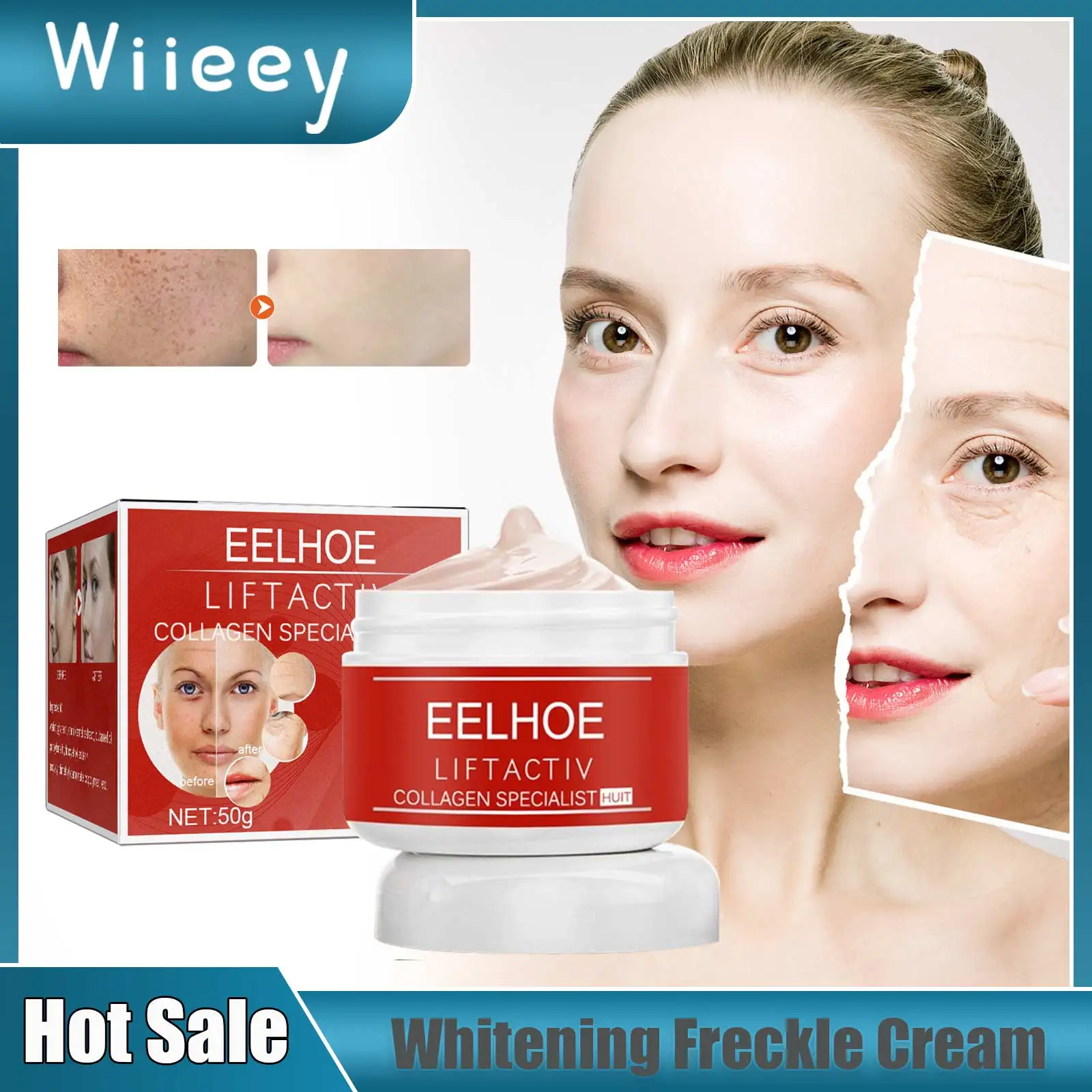 

Whitening Freckle Cream Remove Melasma Dark Age Spots Anti Aging Fade Fine Lines Pigmentation Reduce Melanin Brighten Cream 50g