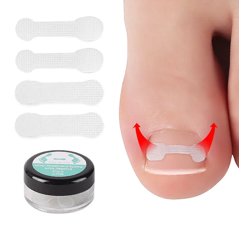 

20-4PCS Ingrown Toe Nail Treatment Ingrown Toenail Correction Tool Elastic Patch Sticker Straightening Clip Brace Pedicure Tools