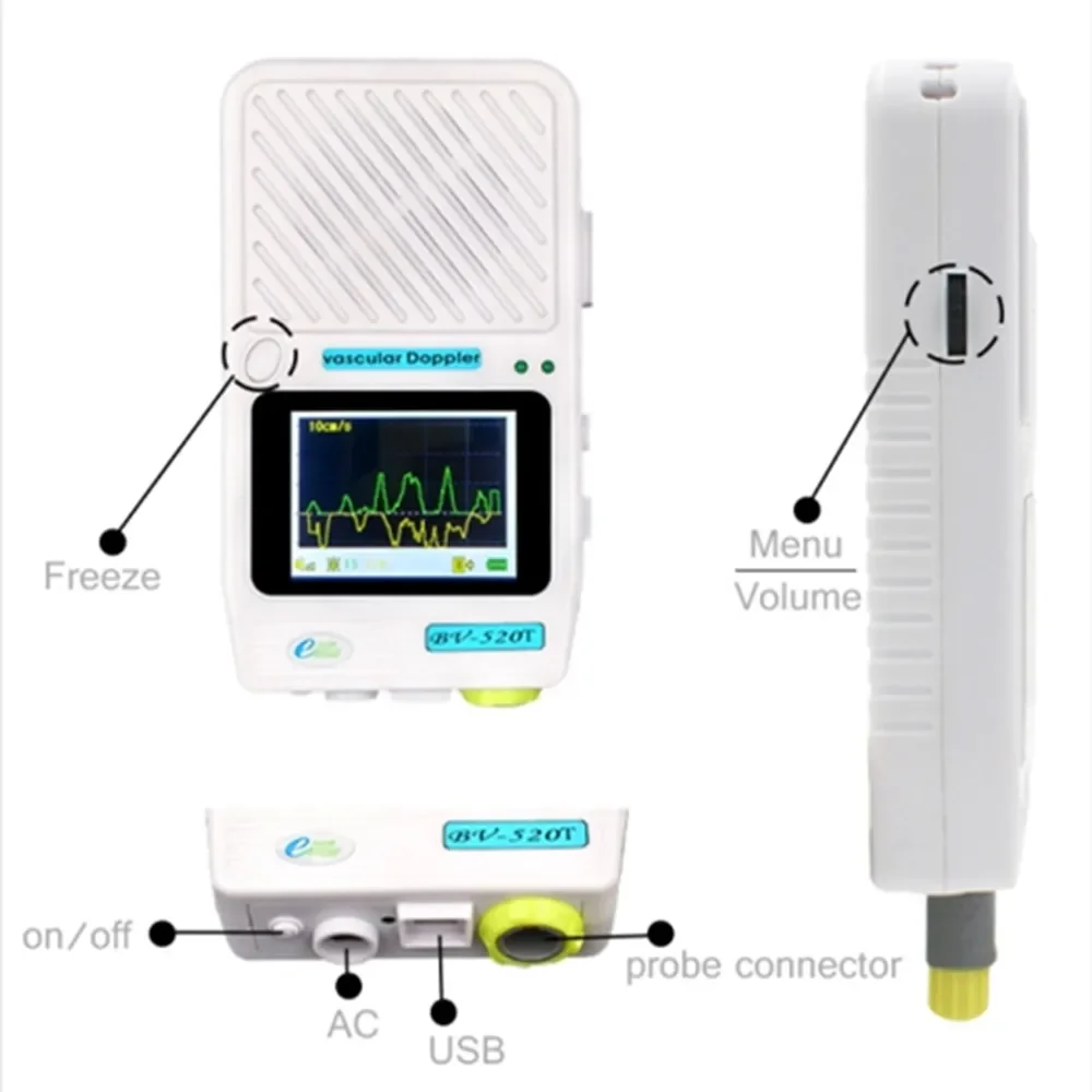 Vasuclar допплер-детектор скорости с 8 МГц зондом детектор кровяного потока