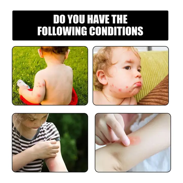 Natural Bug Spray 4