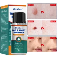 20ml warts removal cream painless face skin tags pimple treatments serum mole skin dark spot warts remover essential oil cream