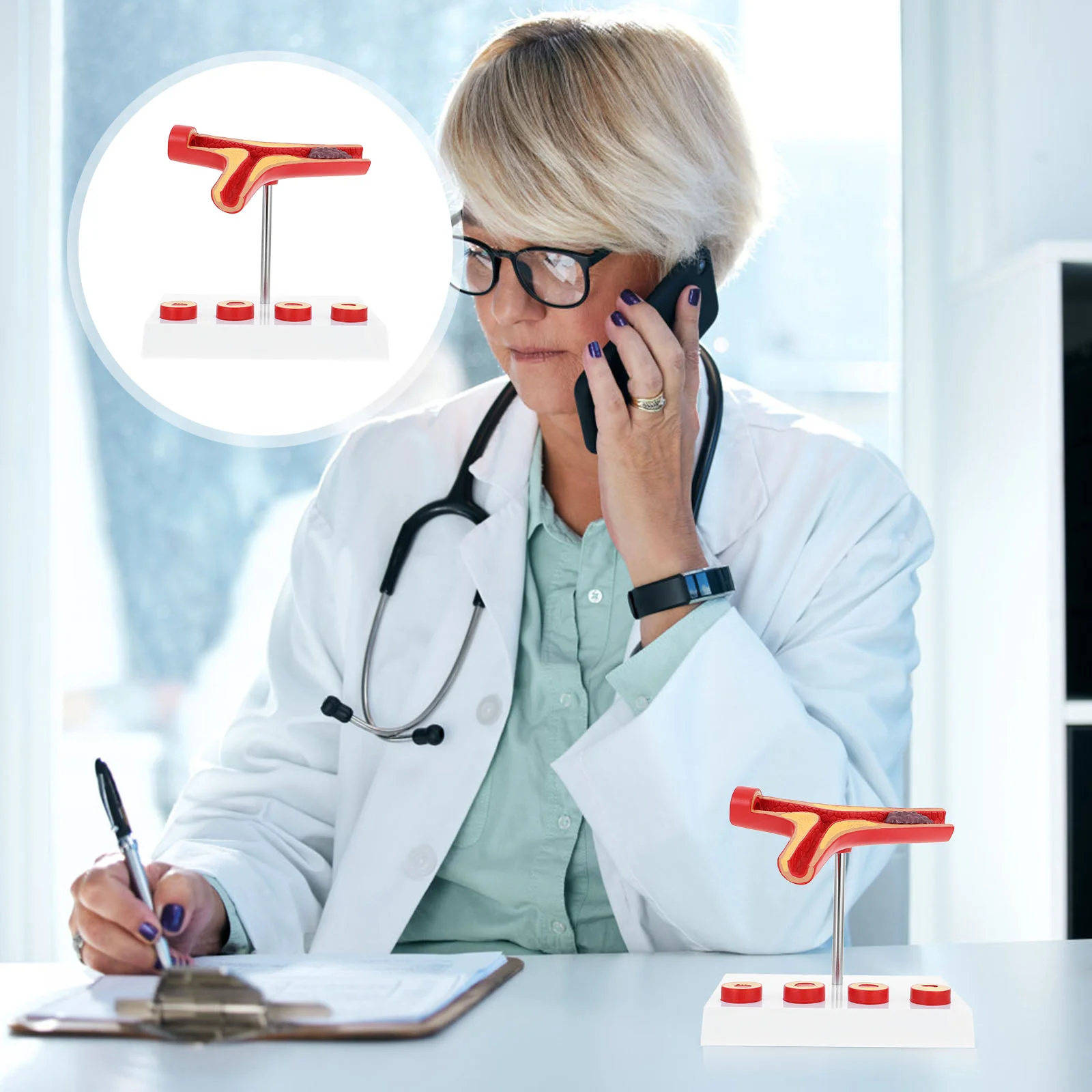 

Atherosclerosis with Thrombus Model Atherosclerosis Teaching Model