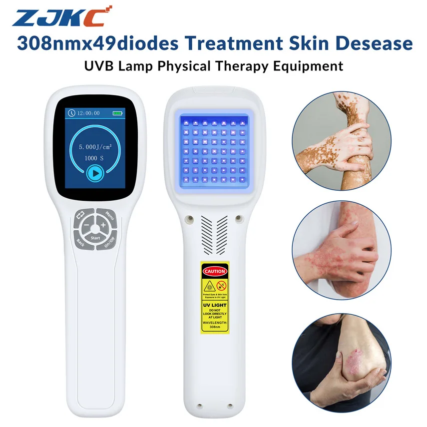 Эксимер ZJKC нм Uvb фототерапия устройство для фототерапии Vitiligo светильник лечение
