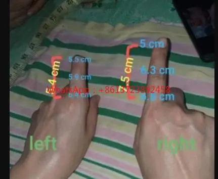 Искусственные конечности силиконовые пальцы протезированные под заказ