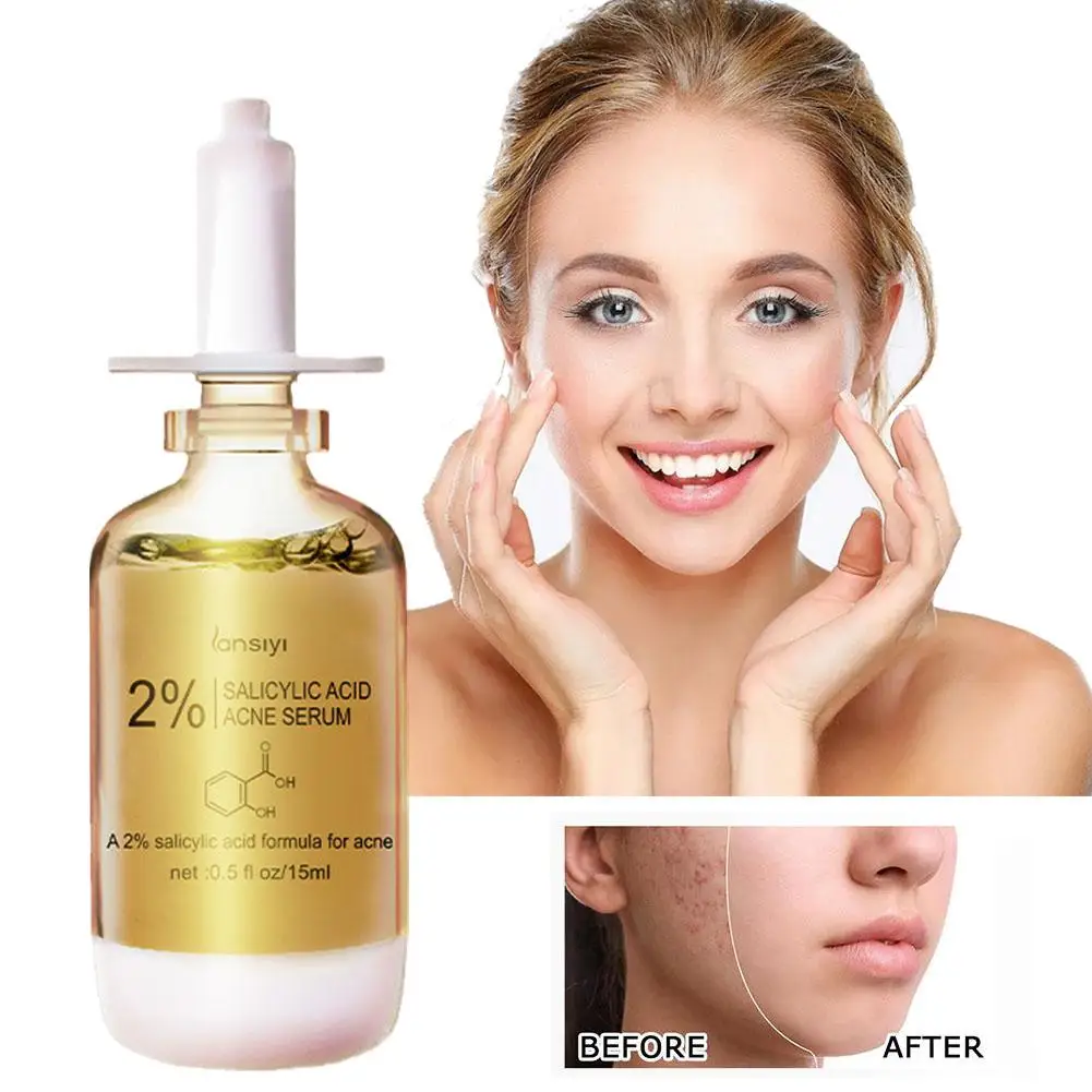 

Salicylic Acid Acne Removal Moisturizing Oil Control Facial Skin Black Beauty Pores Care Treatment Products Dots Shrink O6H8