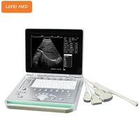 medical ultrasound instruments portable ultrasound scanner ultrasound machine price