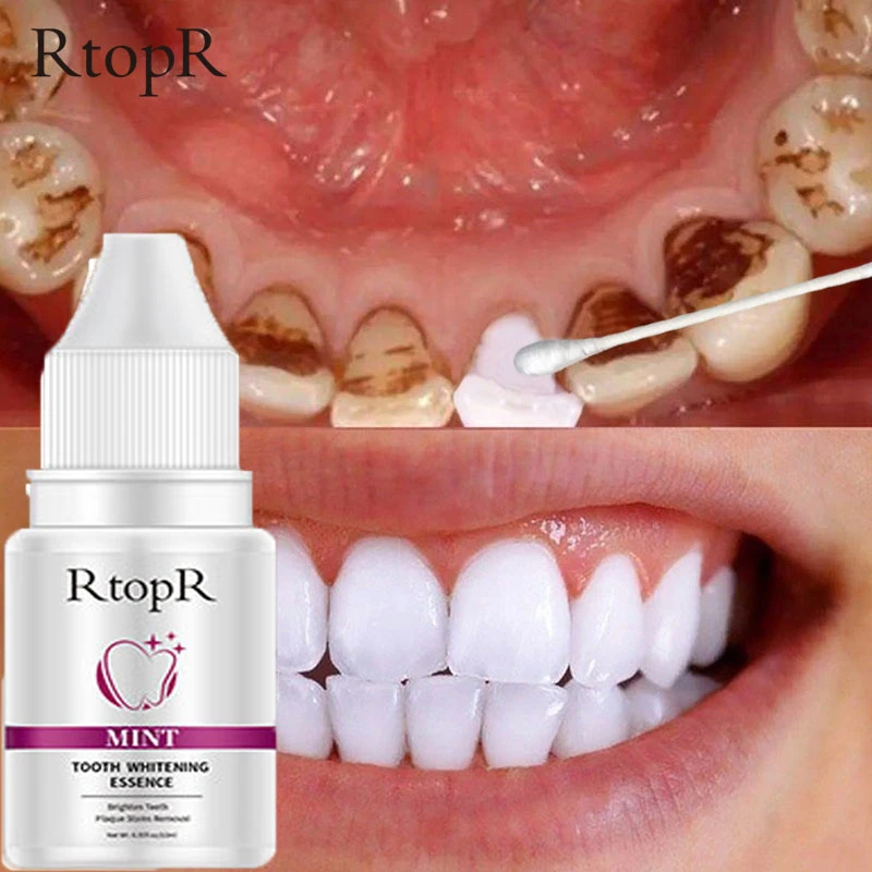 Teeth Whitening Serum Remove Yellow Plaque Smoke Coffee Stains Cleaning Oral Hygiene Essence Fresh Breath Bleaching Dental Care