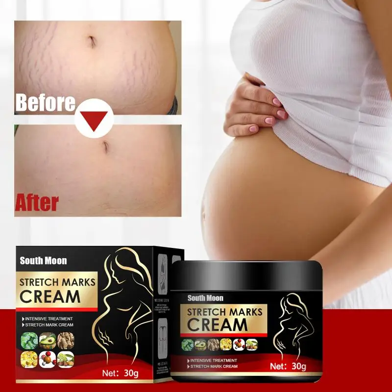 

Stretch Marks Removal Cream Stretch Mark Buttock Breast Obesity Scars Removal Pregnancy Whitening Repair Maternity Body Care 30G