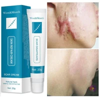 herbal acne scar cream fade dark spot removal acne spot burn surgery scar stretch mark treatment smooth whitening facial 20ml