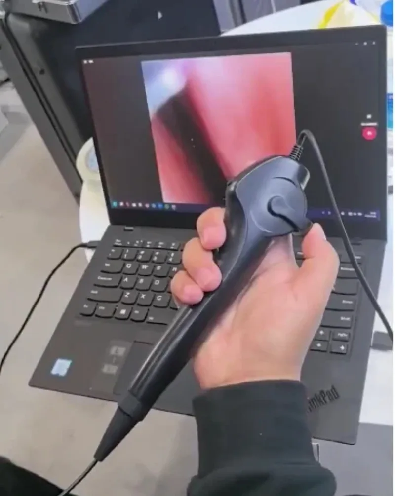 Фото 2025ENT 3,5 мм HD Rinolaringoscópio Portátil Baixo Preço Endoscopia Flexível Para Rhinolaryngoscope №1