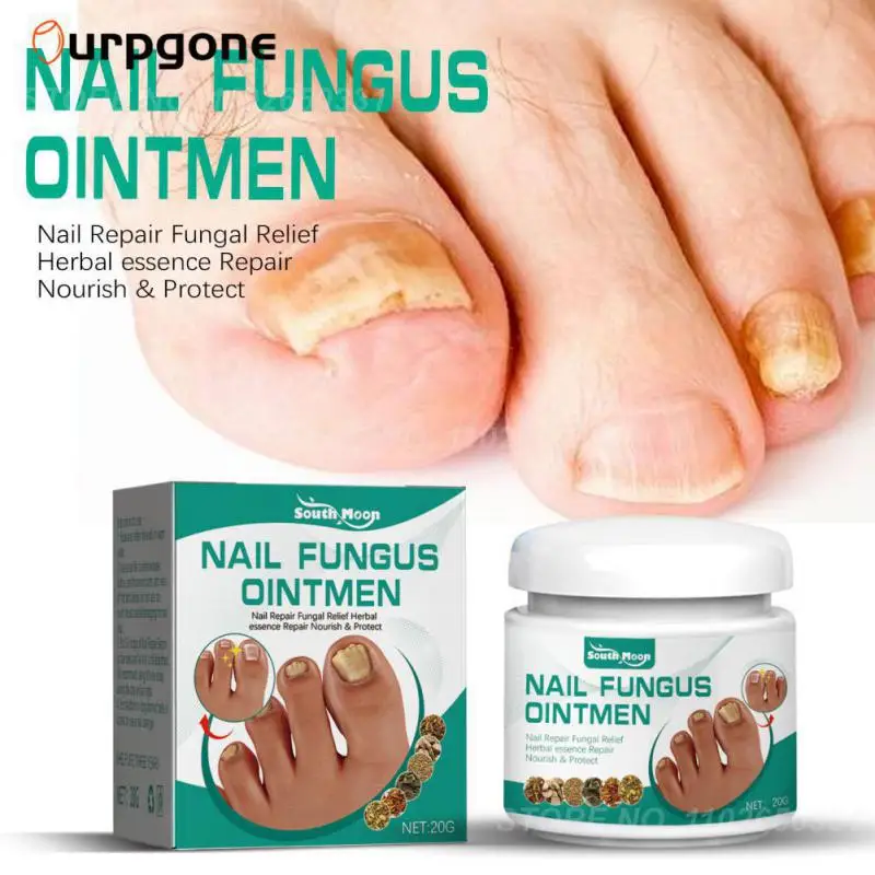 

Мазь для ухода за ногтями против онихомикоза уход за паронихией Лечение грибка ногтей противогрибковый крем для ногтей 20 г