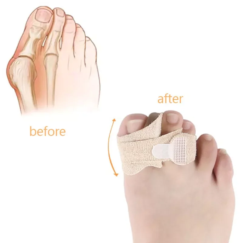 

1PCS Hallux Valgus Correction Silicone Bandage Foot Care Gel Bunion Protector Toe Separators Straightener Correctors 2 Styles