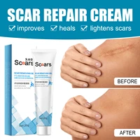 20g acne scar removal cream gel stretch marks remove acne spots burn surgical scars treatment smooth whitening face body care
