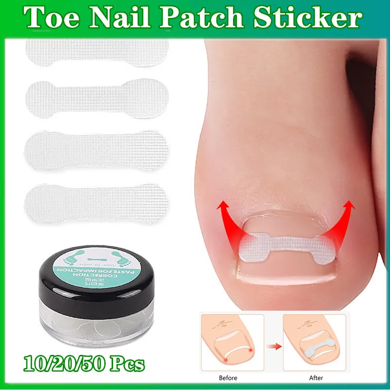 

10pcs Ingrown Toe Nail Treatment Ingrown Toenail Correction Tool Elastic Patch Sticker Straightening Clip Brace Pedicure Tools