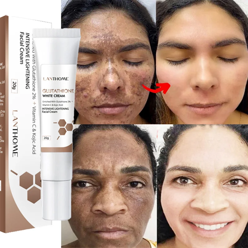 

Premium Glutathione Cream for Skin Whitening & Freckle Lightening Melanin Removal Melasma Remover Moisturize Brighten Whitening