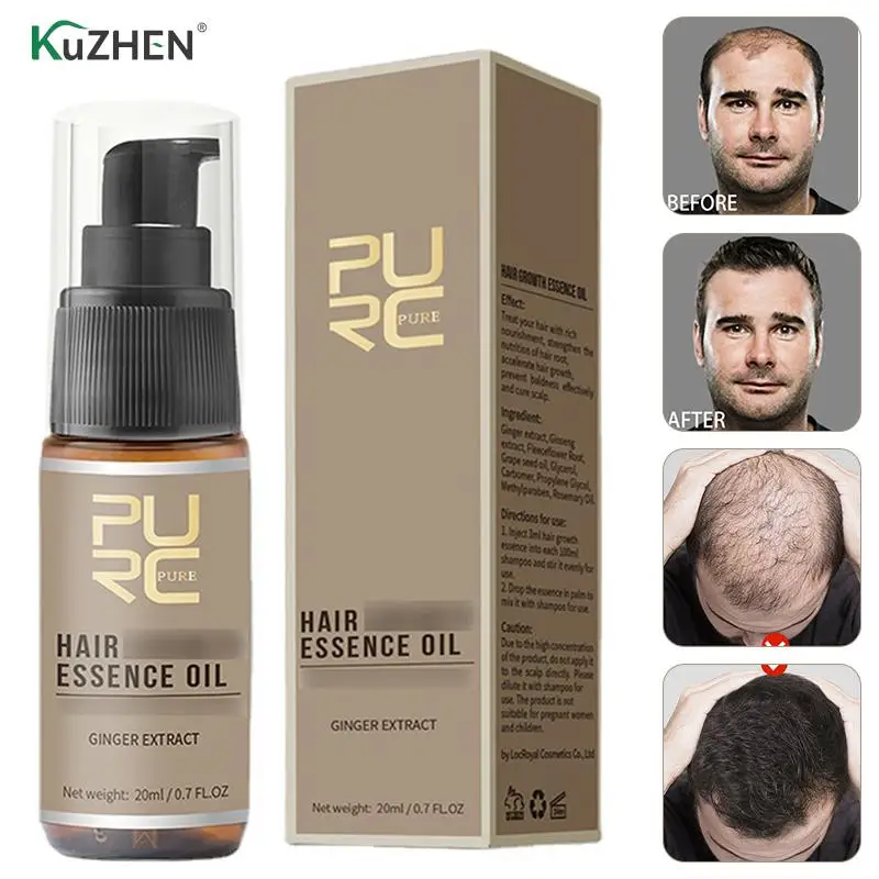 

Ginger Hair Growth Spray Serum Anti Hair Loss Products Fast Growing Anti Lost Beauty Repair Scalp Frizzy Damaged Hair Care