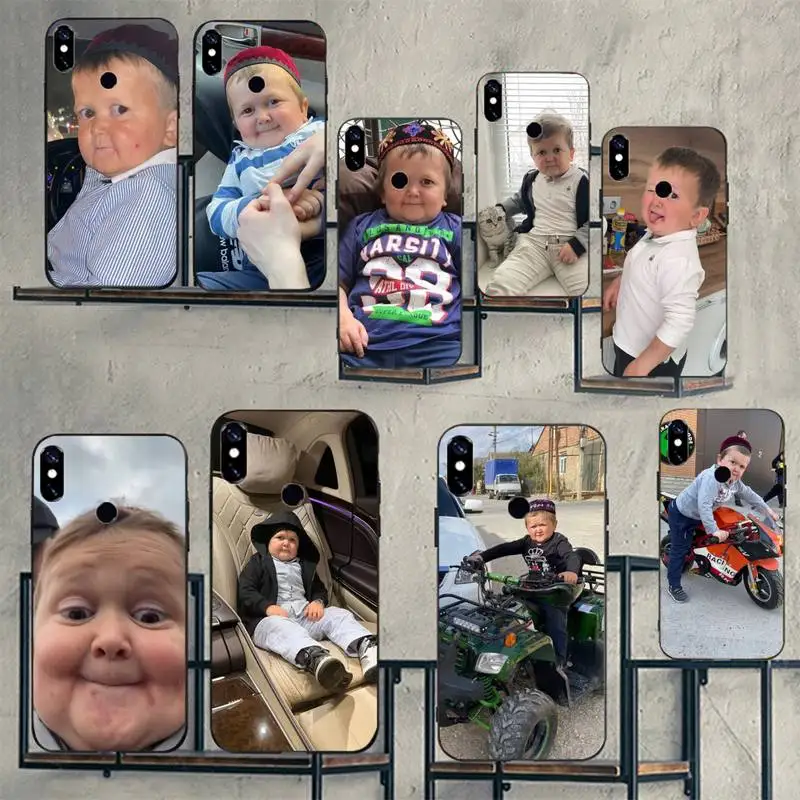 

Hasbulla Boy funny cute Phone Case for Xiaomi redmi note 12 11 10 7 8 9 4G 5G T S i ultra poco X3 pro