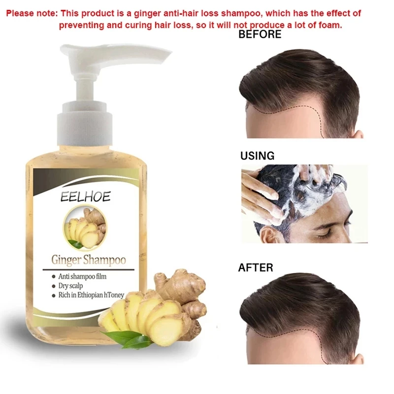 60ml Ginseng Anti-Hair Loss Shampoo Powerful Treatment  Essence Herbs Ginger Cooler Hair Growth Lotions free shipping