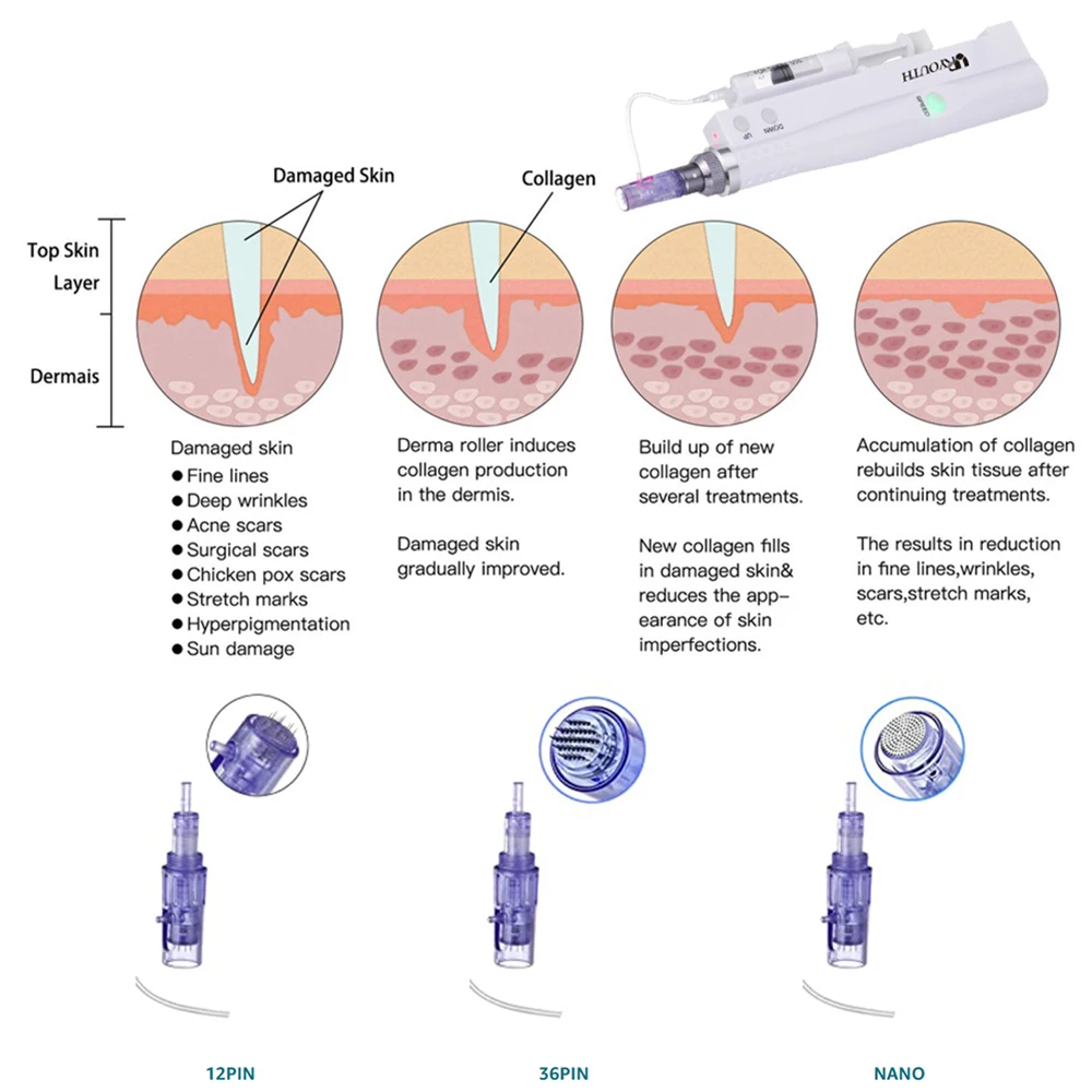 Рисунок 6 - Инжекторное устройство для мезотерапии