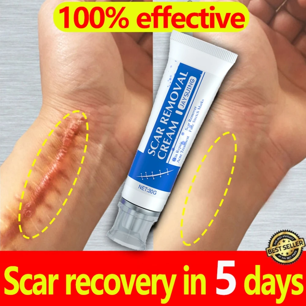 

5 Days Scar Removal Cream Gel Fast Recovery Surgery Scars Treatment Acne Spots Stretch Marks Burn Repairing Skin Beauty Care 30g