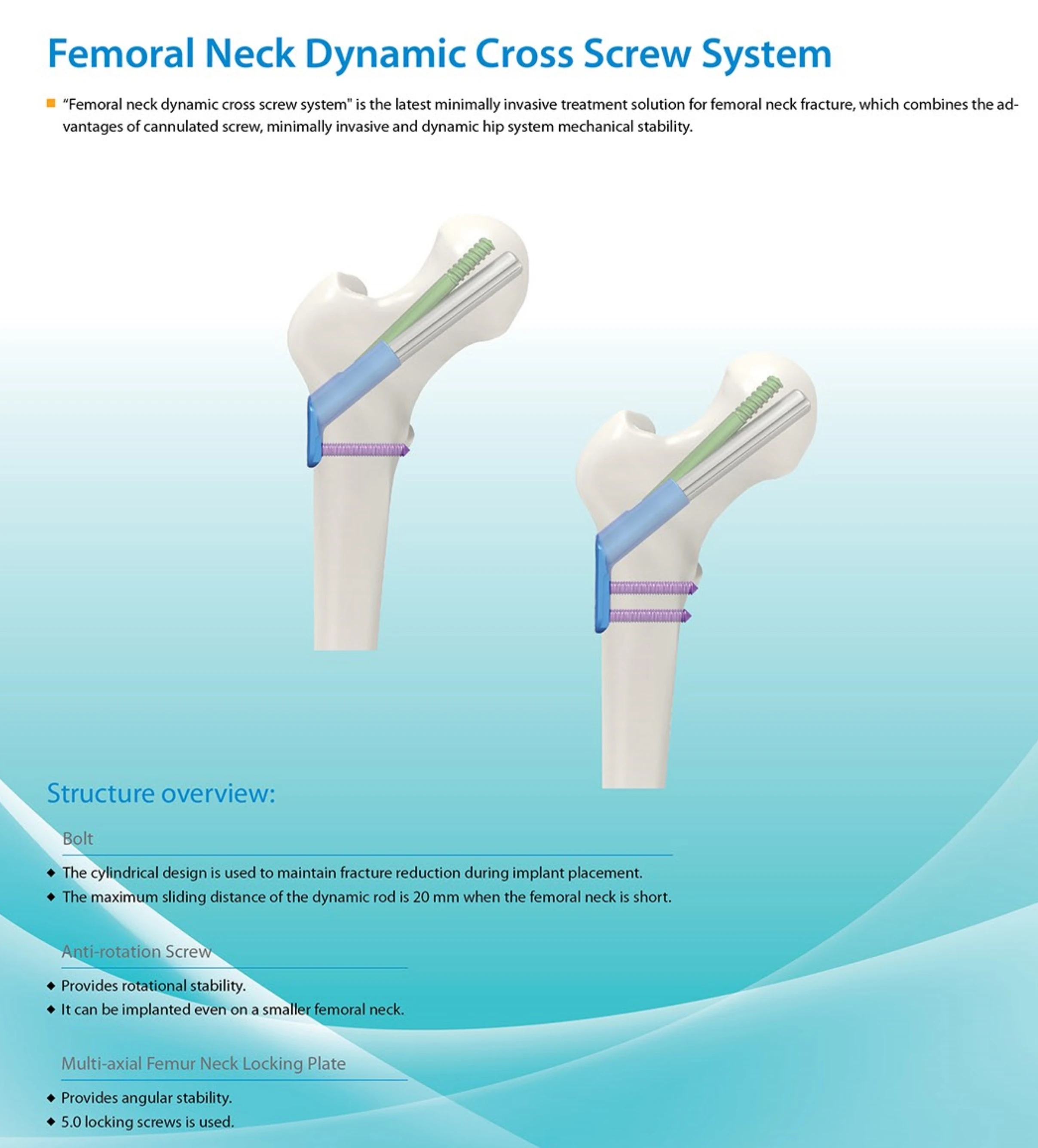 Медицинские ортопедические имплантаты Jinlu: Многоосевая блокирующая пластина для шейки бедренной кости (art.: 3920d965f722c) - 3920d965f722c