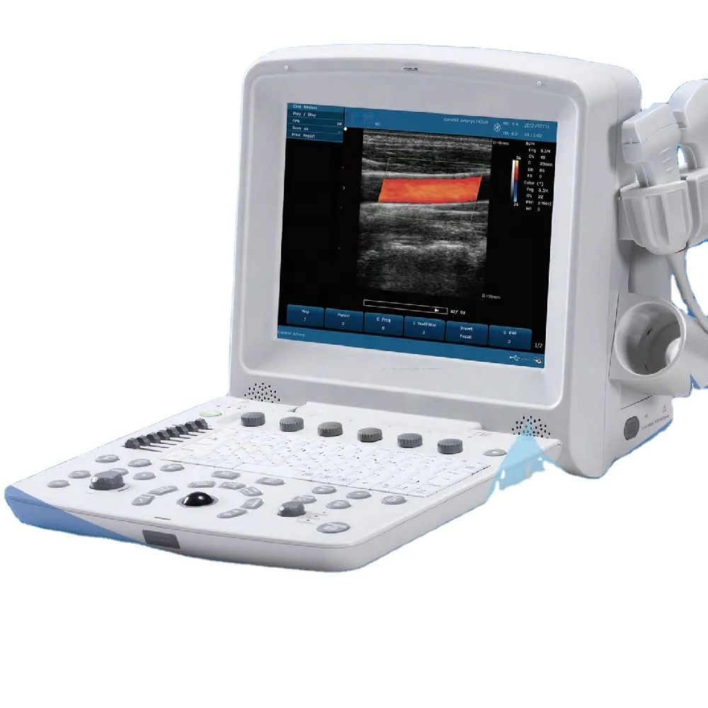 

80% off ultrasound Edan U50 with convex array and linear array probe