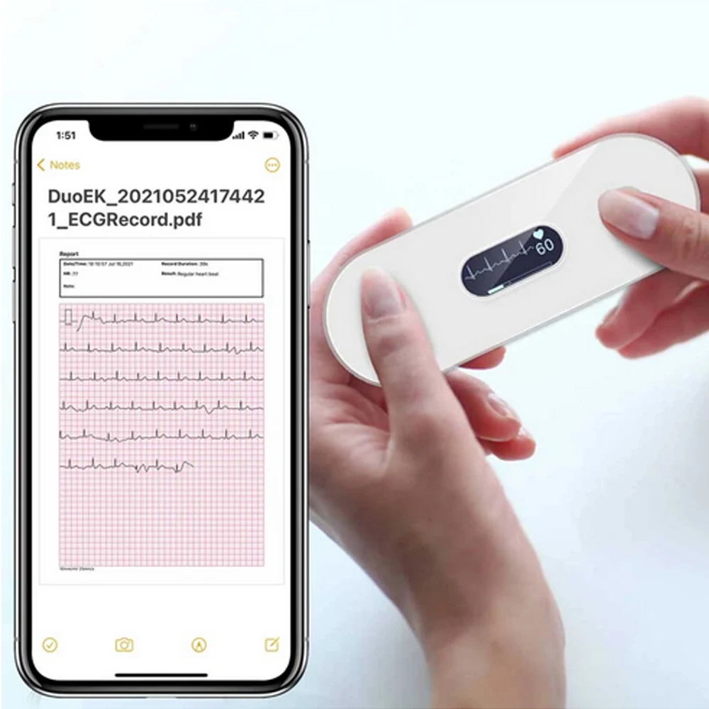 

Bluetooth ECG Holter With OLED Screen Charge EKG Heart Health Monitor Hand Held Mini EKG Monitor Unlimited Storage Share Report