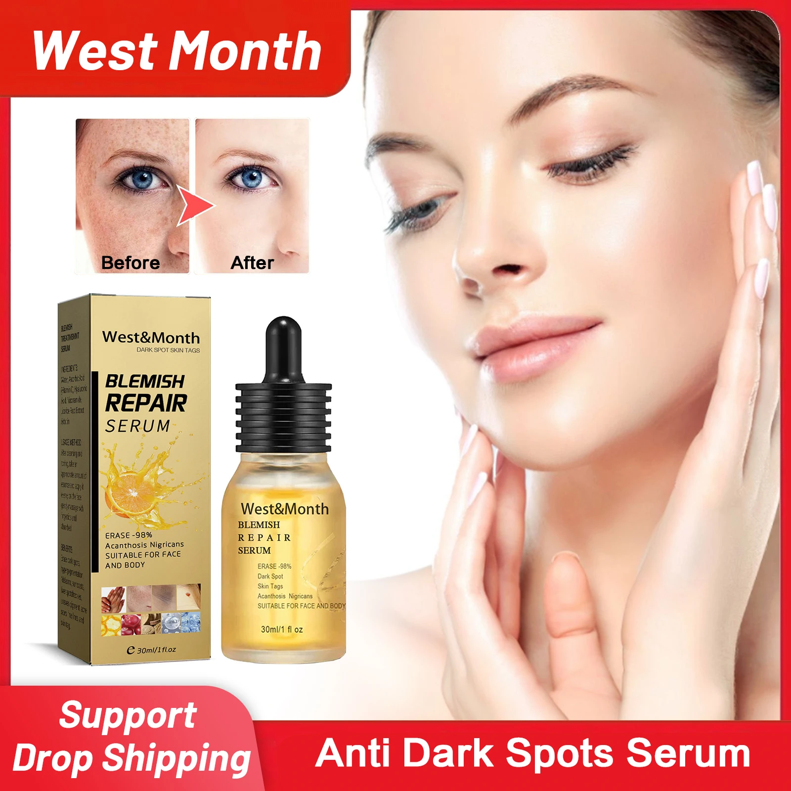 

Anti Dark Spots Serum Fade Freckle Melasma Brighten Pigment Removal Melanin Correcting Niacinamide Whitening Facial Essence 30ml
