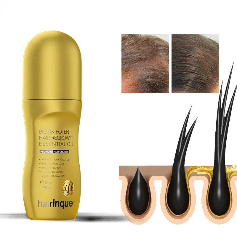 Hairinque Vitamin B7 Hair Growth Products Prevent Hair Loss Serum Scalp Treatments Growing Hair Care Oil for Men Beauty Health
