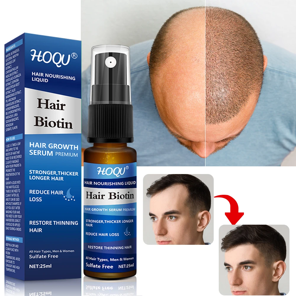 Имбирный спрей для роста волос сыворотка предотвращения - Цена: 126.85