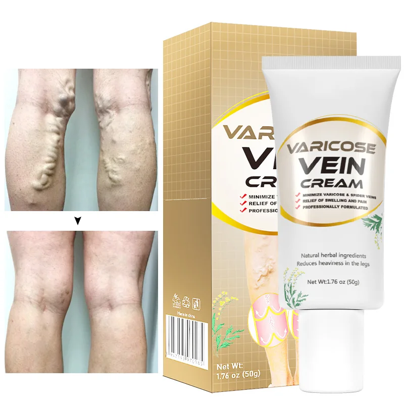 

50g Varicose Vein Cream Soothing Repair Pain Relief Cream Promotes Blood Circulation Phlebitis Spider Vein Herbal Body Care