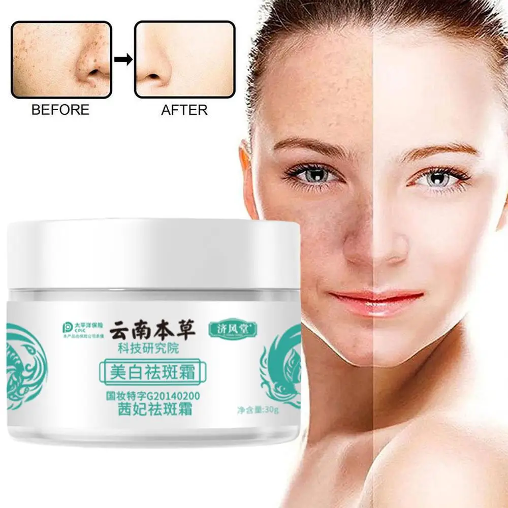

30g Brighten Skin Colour Spot Cream Moisturize Skin Facial Freckle Cream Care Natural Cream Extracts Melasma Ingredients N0H1