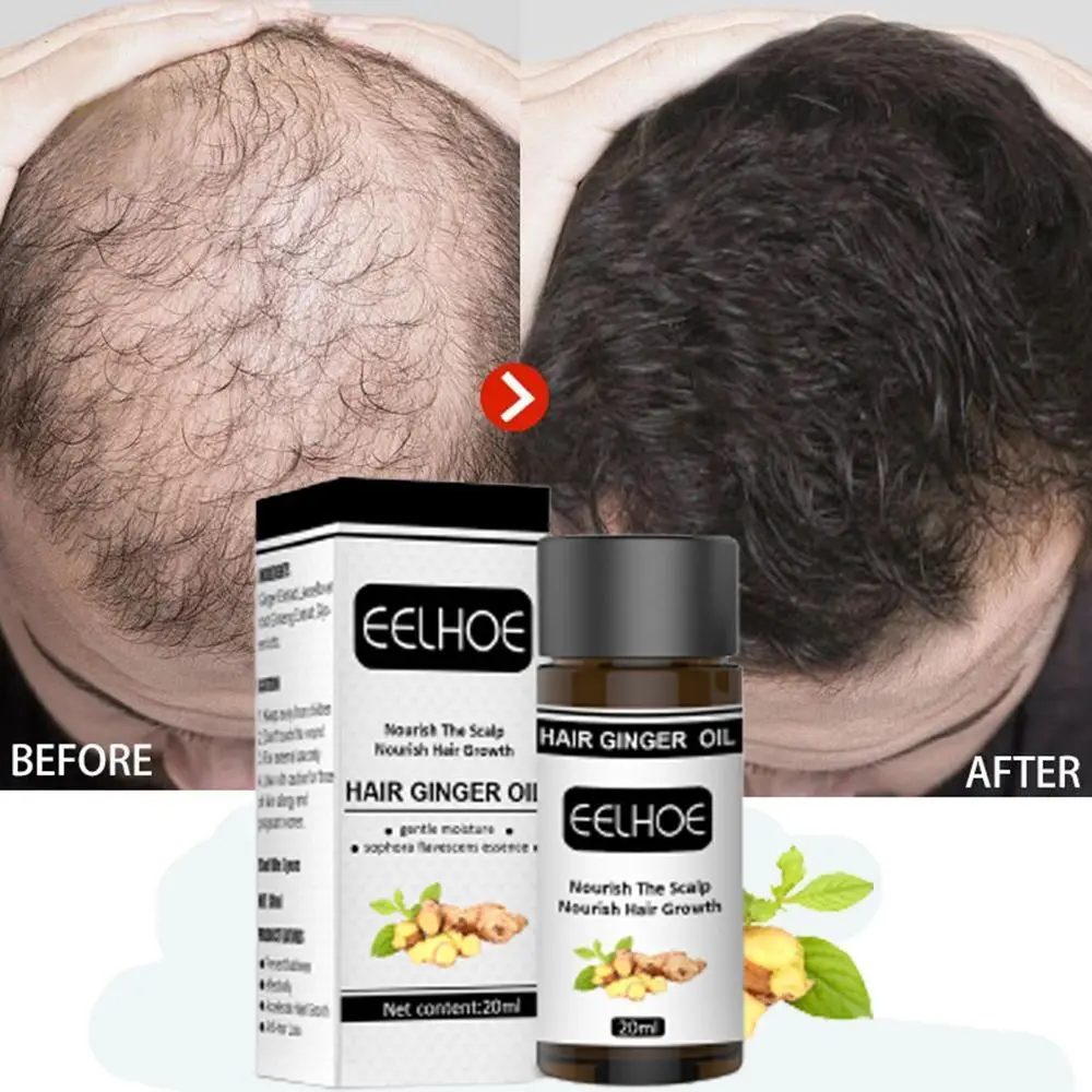 

Ginger Hair Growth Essential Oil Serum Hair Treatment Anti Lost Beauty Products Fast Grow Repair Scalp Frizzy Damaged Hair Care