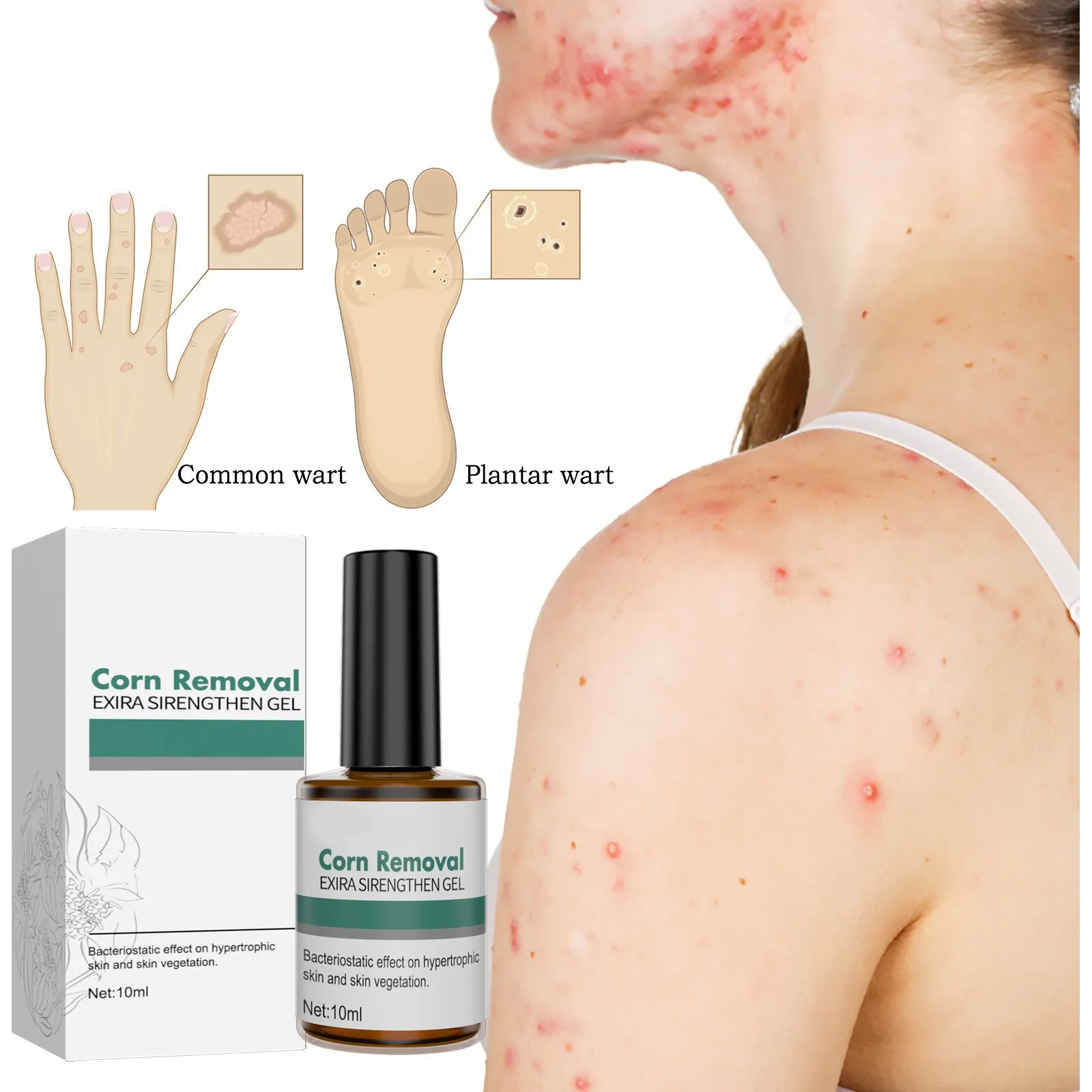 

Effective Liquid For Various Types Of Skin Lesions: Corns Warts And Cornified Epidermal Tags 10ml