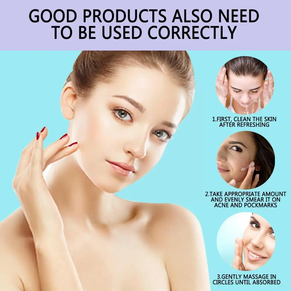 

Acne Essence Strong Effect Powerful Whitening Cream Melasma Freckles Melanin Whitening Pigment Remove Remove Dark Stains T4r4