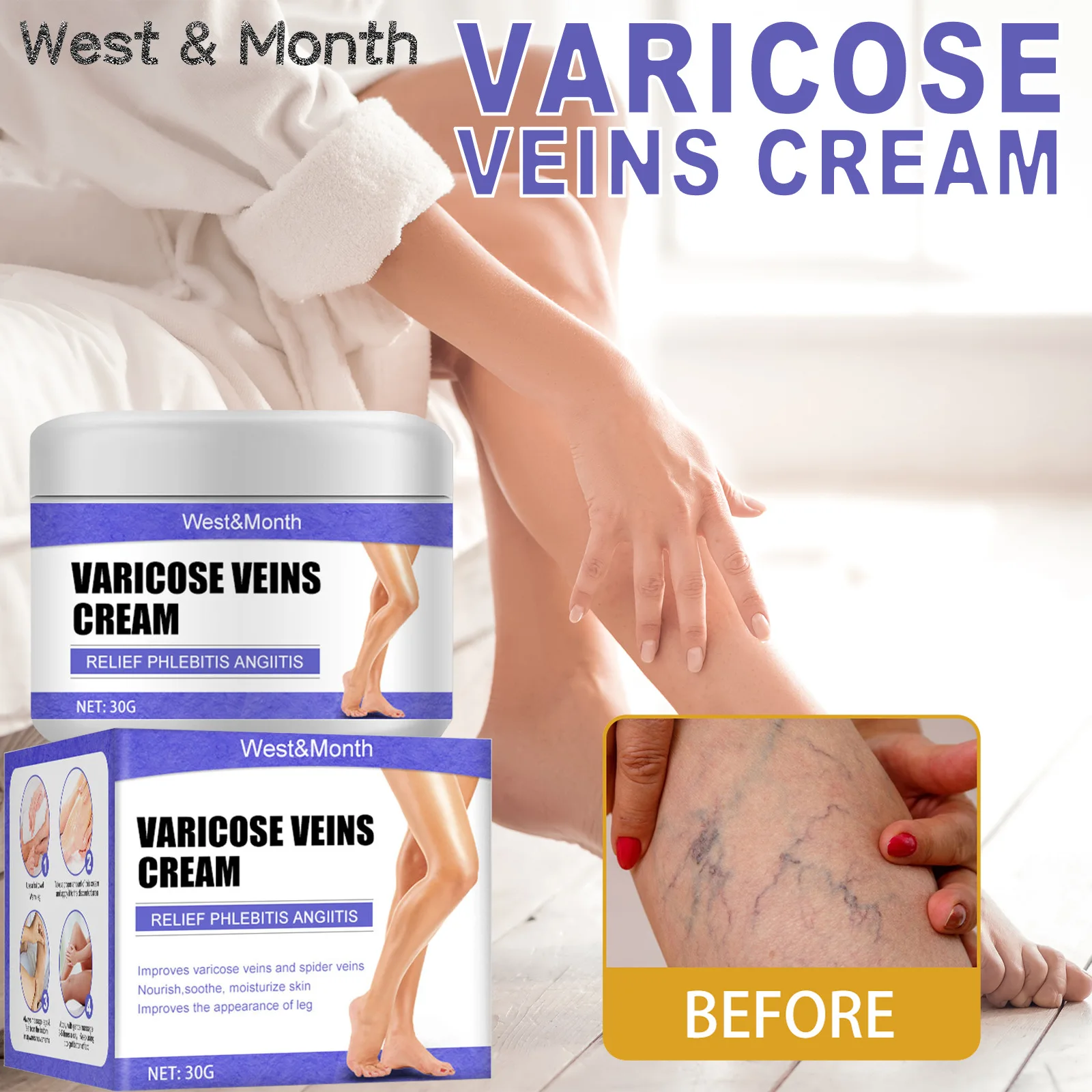 

30g Effective Varicose Veins Relief Body Cream Relieve Vasculitis Phlebitis Spider Pain Treatment Medical Plaster Body Care