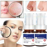 pore savior shrinking pore essence refreshing oil control shrinking pores repairing thick plant essence skin care products