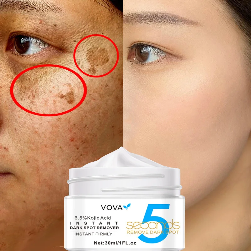 

Instant Whitening Freckle Removal Face Cream Fade Dark Spots Melanin Melasma Shrink Pores Brighten Moisturizing Korean Cosmetics