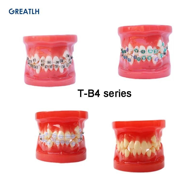 Стоматологическая модель с брекетами стоматологические материалы