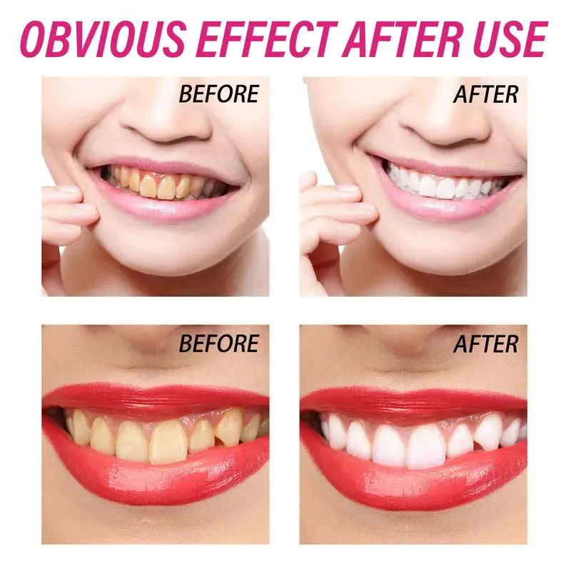 Рисунок 3 - Зубная паста для глубокой очистки зубов