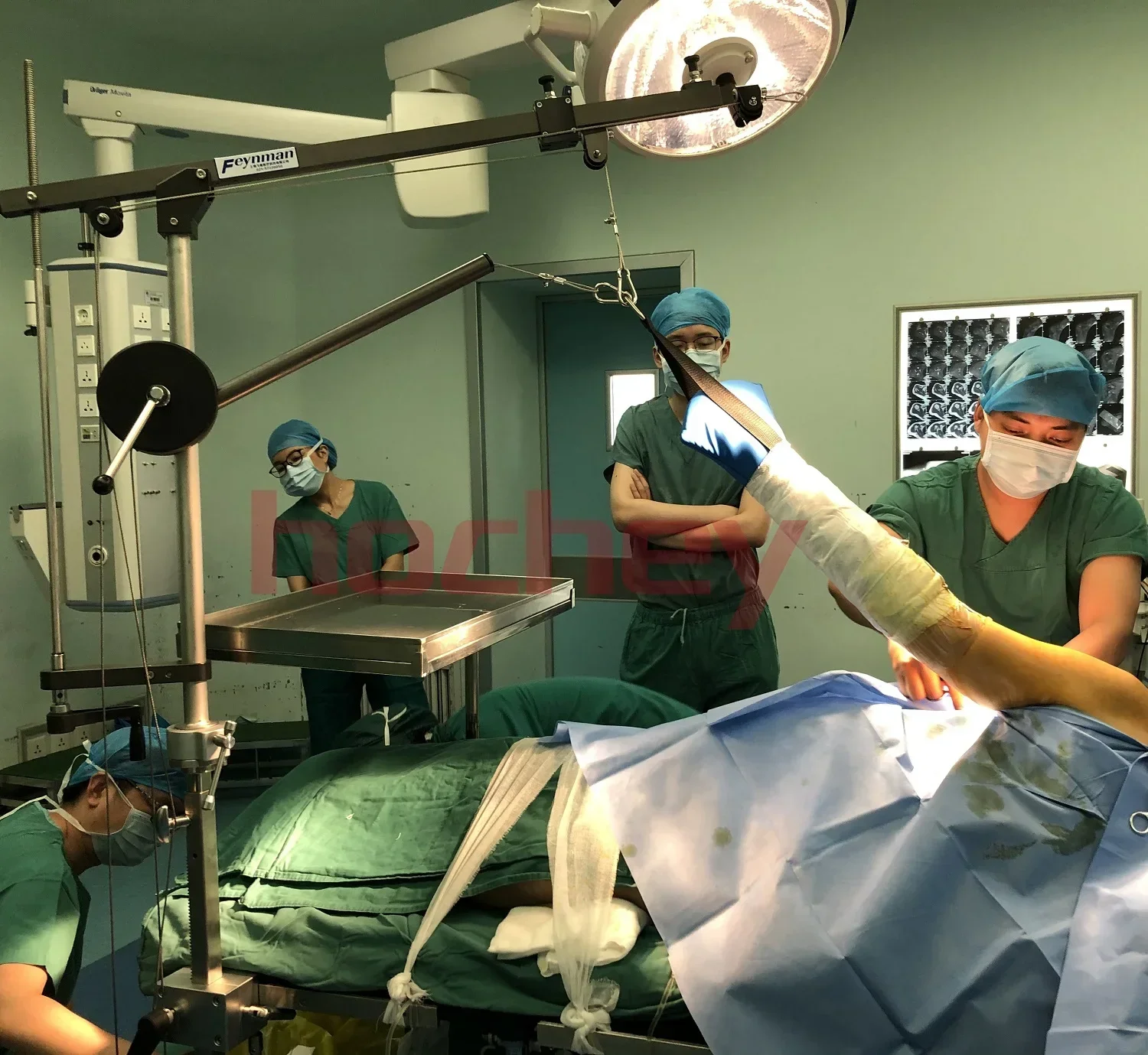 Детали для операционного стола поддержка артроскопии плеч операционная рама