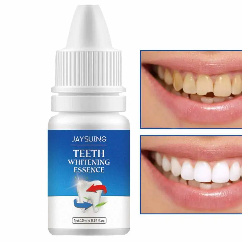 

Teeth Whitening Pen 10ml Teeth Stain Remover To Whiten Teeth Effective Teeth Whitener Toothpaste Quickly Remove Calculus Stains