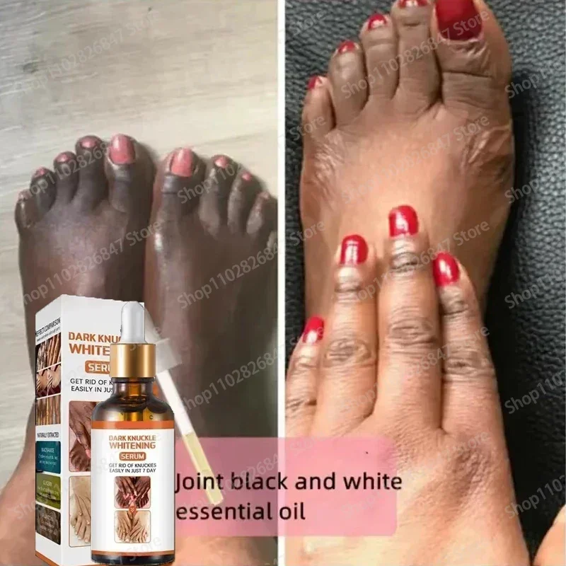 Отбеливающая эссенция для костяшек суставов губ ареолы интимные части нежное