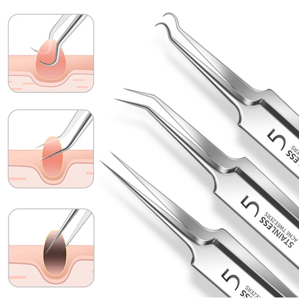 Немецкий Сверхтонкий Пинцет № 5 для чёрных точек клипса специальный инструмент